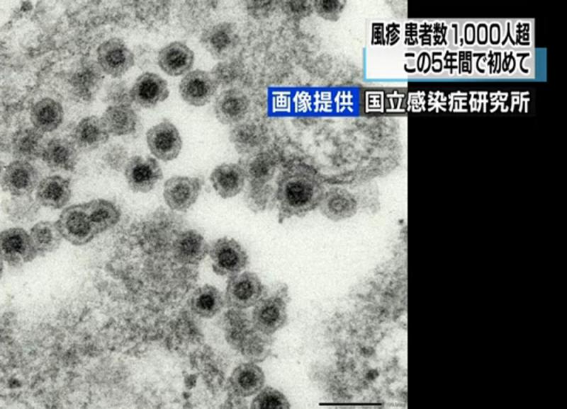 日爆德國麻疹疫情 東京重災