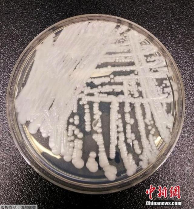 “超級真菌”很可怕？北京市疾控中心回應