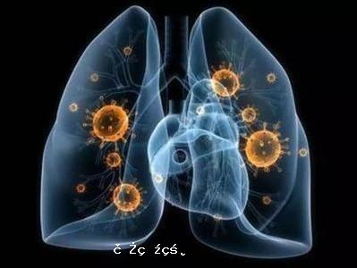 張文宏：新冠肺炎疫情存在全球二次爆發的可能