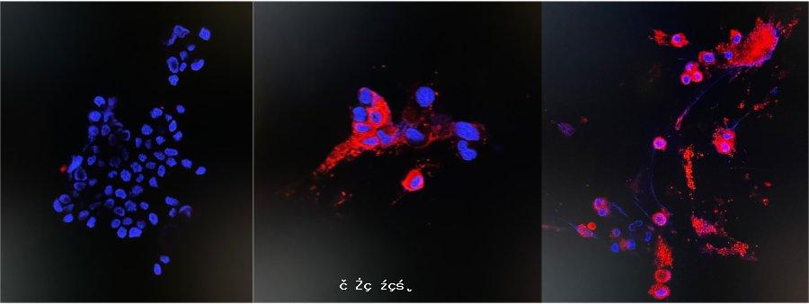 港大料港首兩宗Omicron個案為空氣傳播