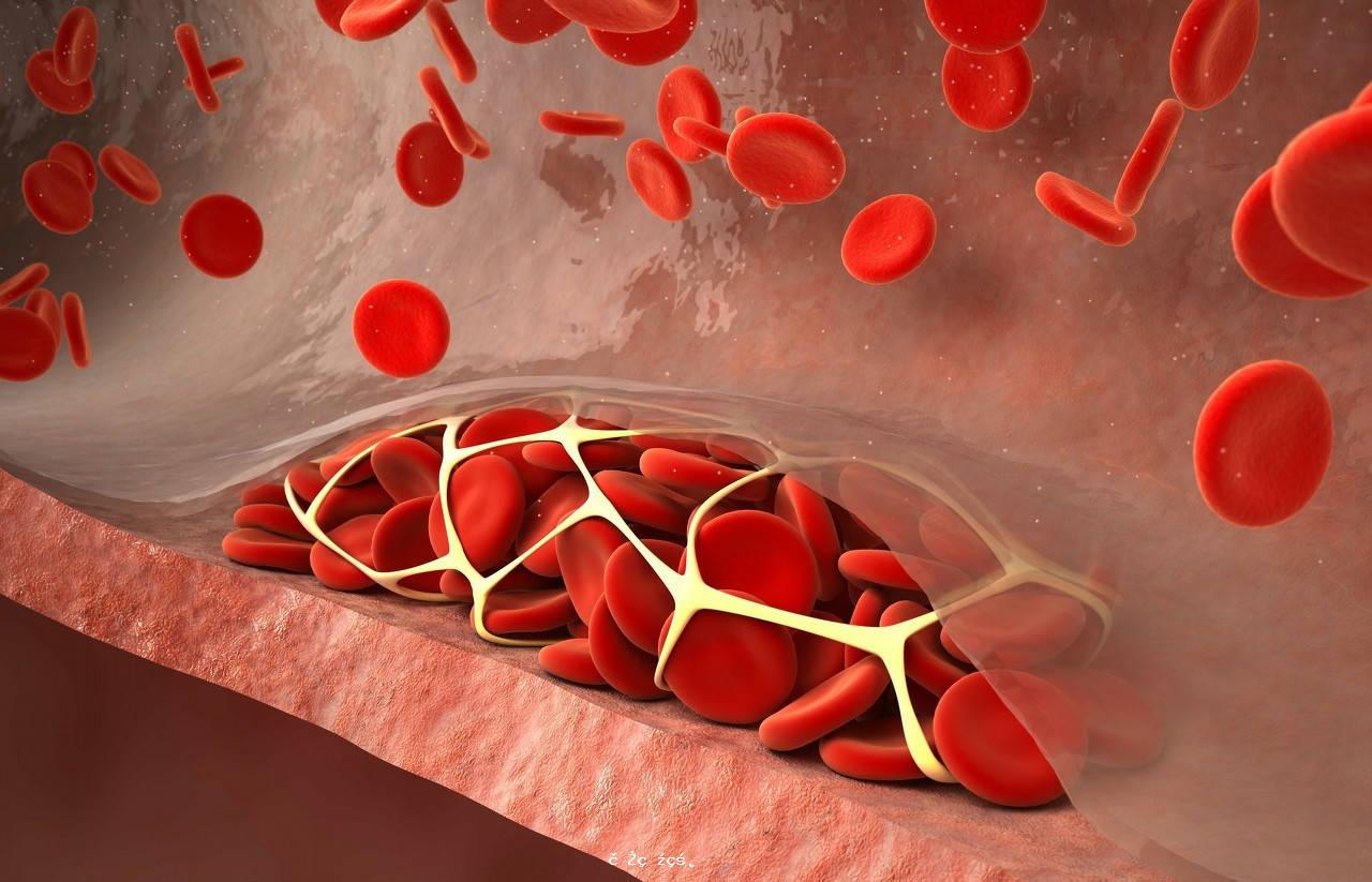 好好的血管怎麽就堵了？當心這些坑你的「通血管」方法 