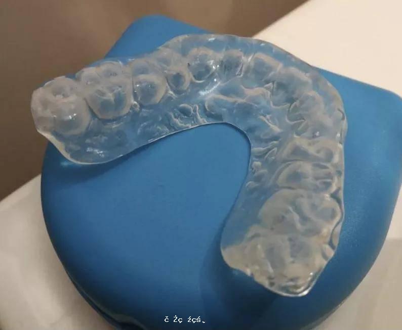網友們好奇的谷愛淩同款牙套是啥樣？